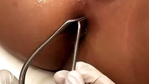 Asian invalid penetrated in anal hole by stud in missionary