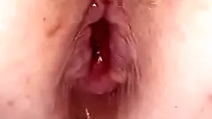 Anal bomb nearby my pain in the neck
