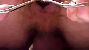 Reciprocal hose enema plus anal stretching